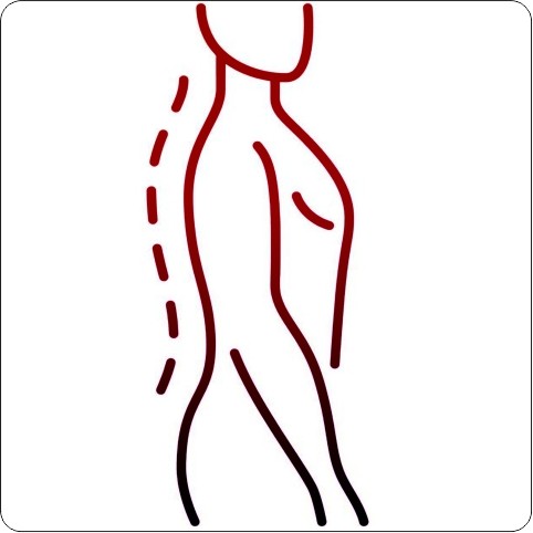 Posture Correction